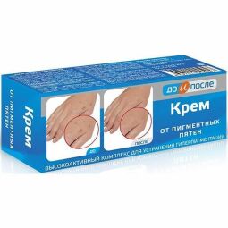 До и после крем от пигментных пятен 50мл